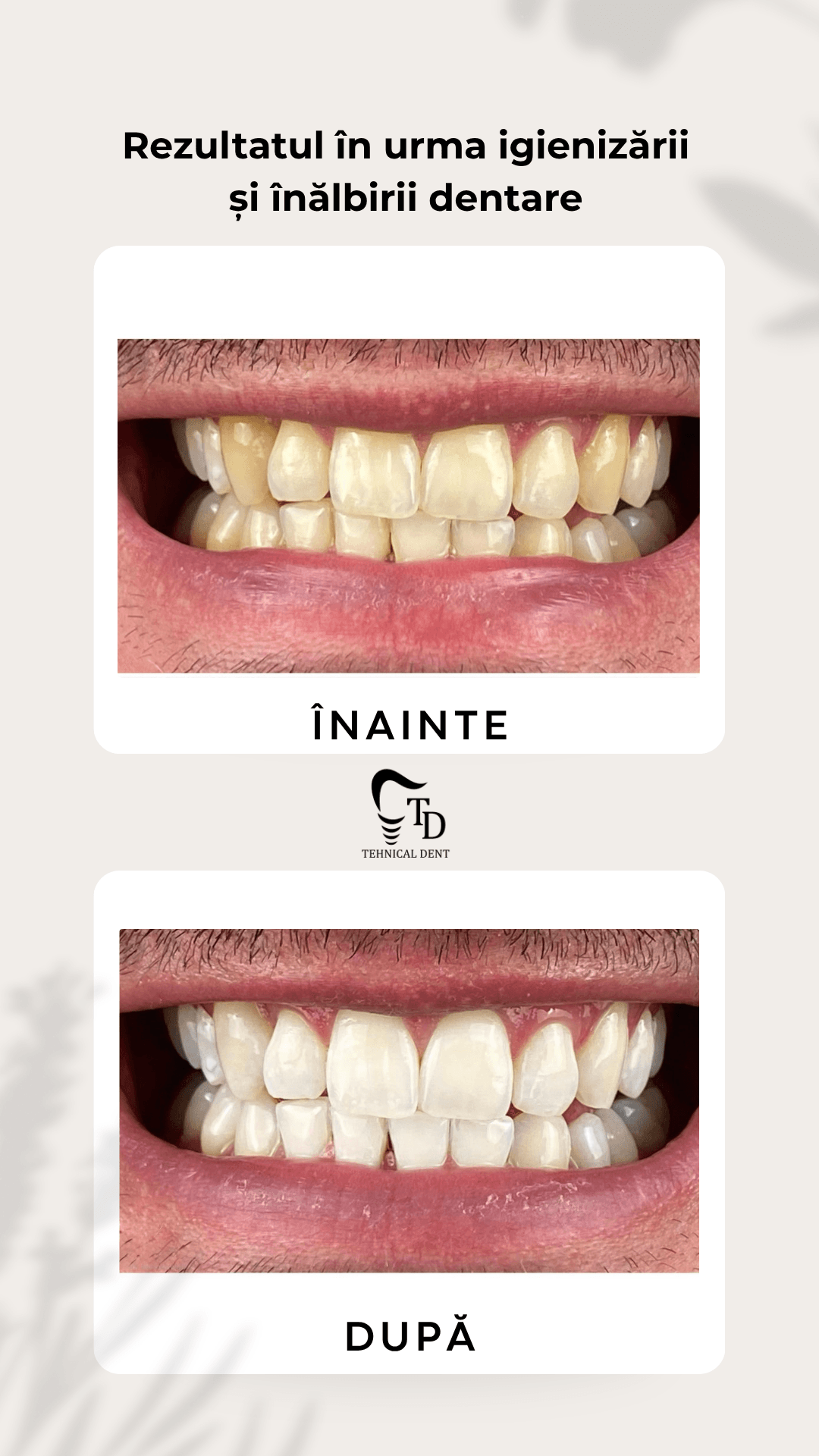 Estetică Dentară — Recuperare și îngrijire