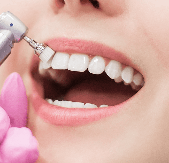 Importanța igienizării dentare profesionale